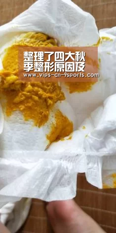 整理了四大秋季整形原因及适合做的下整形项目“九游体育”