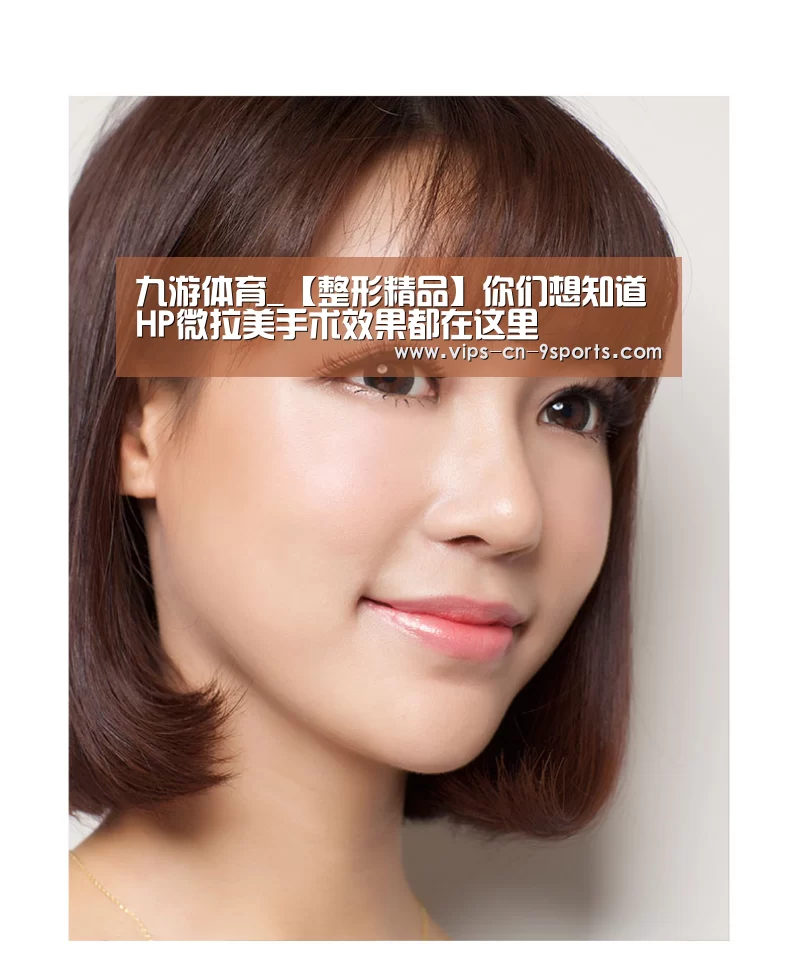 九游体育_【整形精品】你们想知道HP微拉美手术效果都在这里(图2) 九游体育